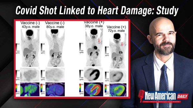 Covid Shot Causes Heart Damage to Asymptomatic Recipients: Study 