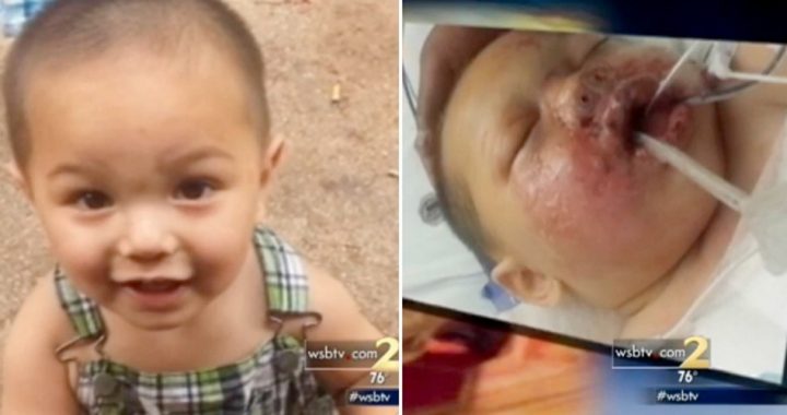 No-Knock Raid: SWAT Team’s Stun Grenade Seriously Injures Toddler