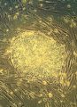 Moving Ahead With Adult Stem-cell Research
