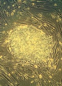 Moving Ahead With Adult Stem-cell Research