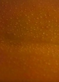 Alternative to Embryonic Stem Cells: Skin